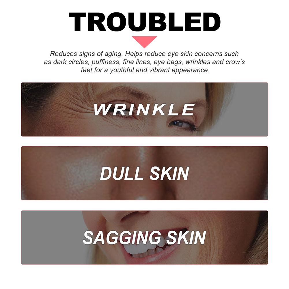 Retinol Oogcrème Verlicht Donk - The Ordinary Serum Hyaluronic Acid recensie en prijs